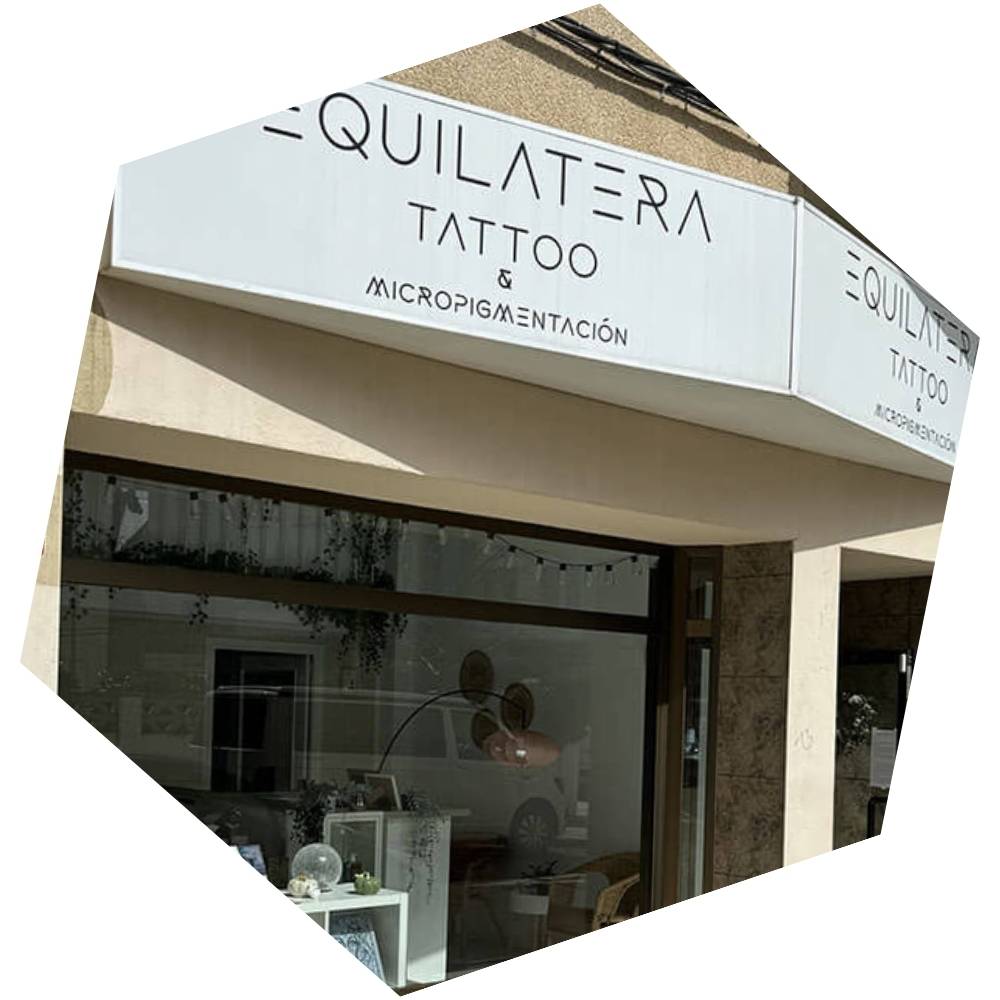Eliminación de tatuajes en Jaca