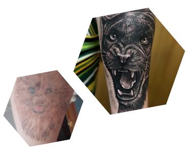 borrar tatuaje con láser eliminación láser blankout